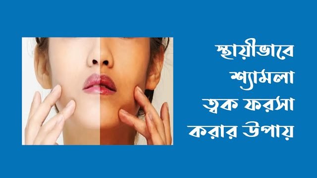 স্থায়ীভাবে শ্যামলা ত্বক ফরসা করার উপায়