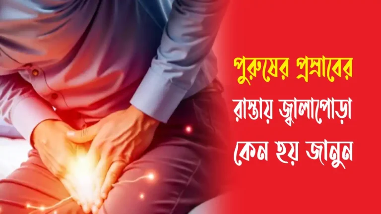 পুরুষের প্রস্রাবের রাস্তায় জ্বালাপোড়া কেন হয়