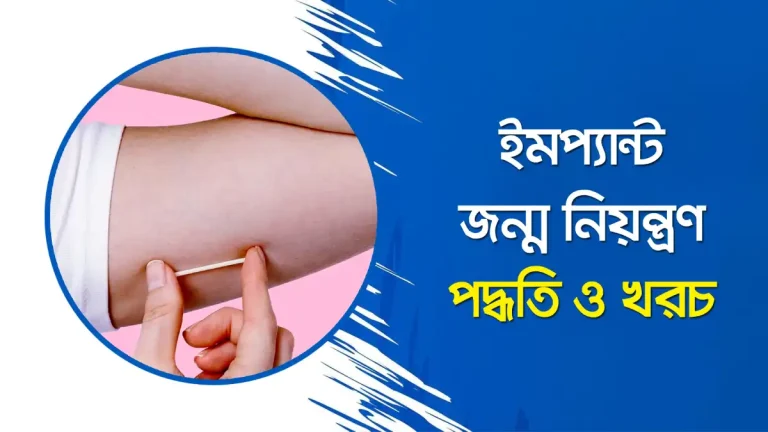 ইমপ্ল্যান্ট জন্ম নিয়ন্ত্রণ পদ্ধতি