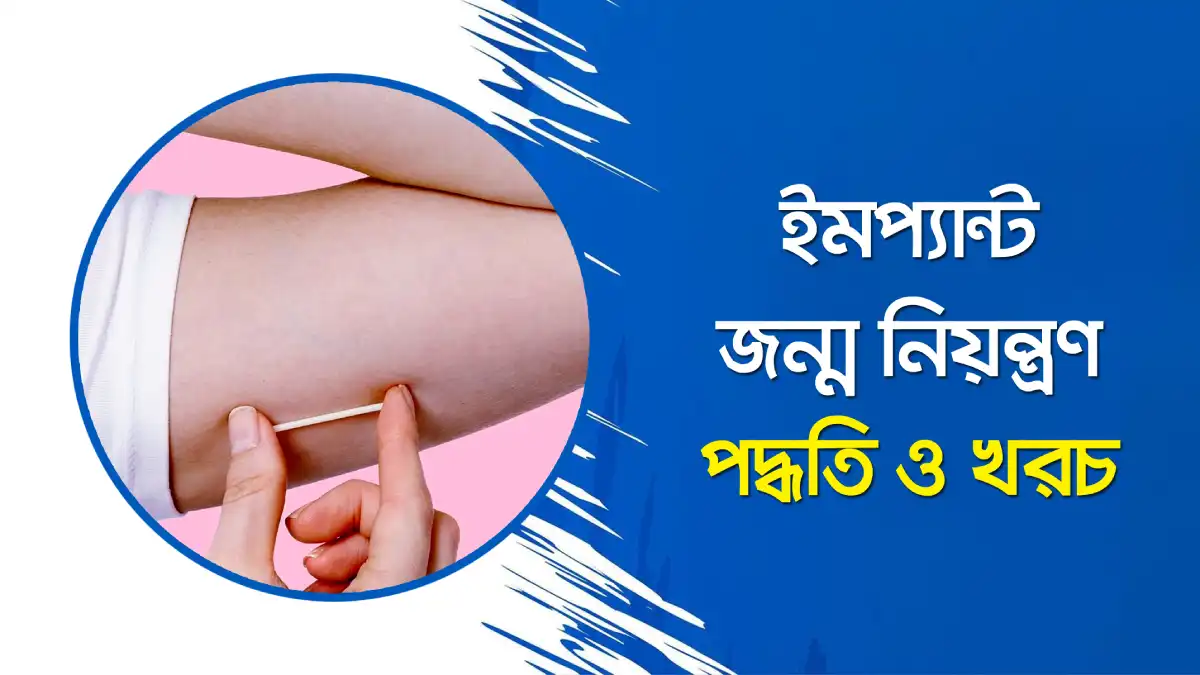 ইমপ্ল্যান্ট জন্ম নিয়ন্ত্রণ পদ্ধতি